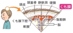 くも膜の場所　Place of arachnoidal membrane